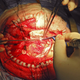 Illustration for article titled Neurosurgeons banned from human research for giving infectious bacteria to brain tumor patients